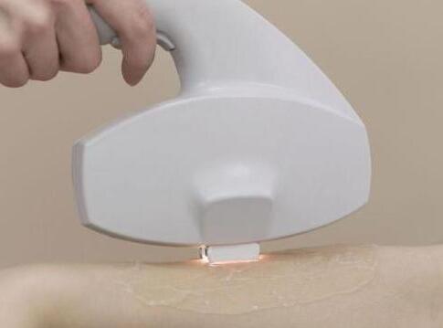 激光脫毛一次大概需要多少錢？詳解費(fèi)用因素與個(gè)人化差異，激光脫毛費(fèi)用詳解，價(jià)格因素與個(gè)人化差異探究