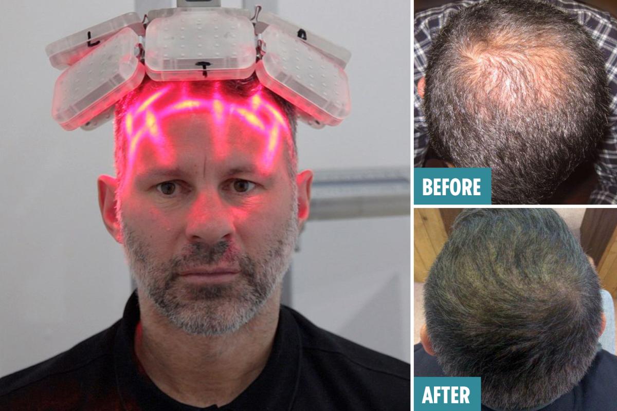 激光手術(shù)費用詳解，多少錢一次？，激光手術(shù)費用全面解析，手術(shù)費用究竟是多少？