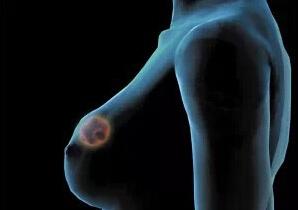 乳腺癌患者的生存期，了解與面對，乳腺癌患者的生存期，了解與面對的挑戰(zhàn)