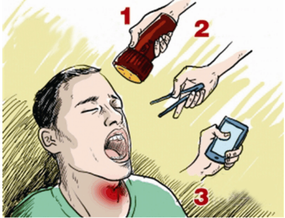 魚刺卡喉嚨自救有妙招，魚刺卡喉自救技巧大揭秘