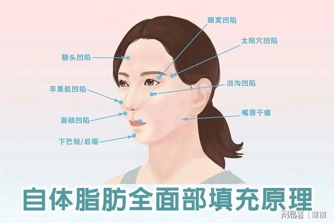 脂肪填充后幾天開始存活，全面解析脂肪填充過(guò)程及其恢復(fù)時(shí)間，全面解析脂肪填充過(guò)程，術(shù)后幾天脂肪開始存活及恢復(fù)時(shí)間揭秘