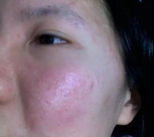 保養(yǎng)皮膚的最好方法，保養(yǎng)皮膚的最佳方法