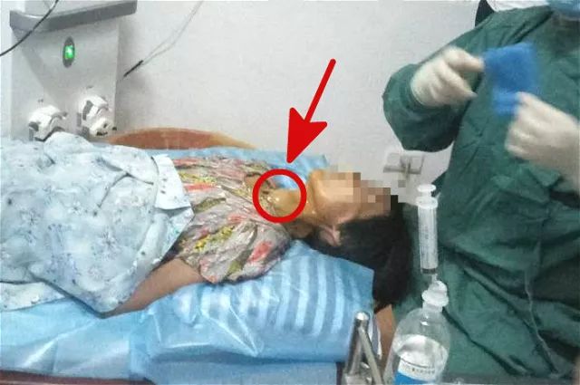 甲狀腺結節(jié)4A持續(xù)二十年，深入了解與管理，甲狀腺結節(jié)二十年持續(xù)觀察與管理策略