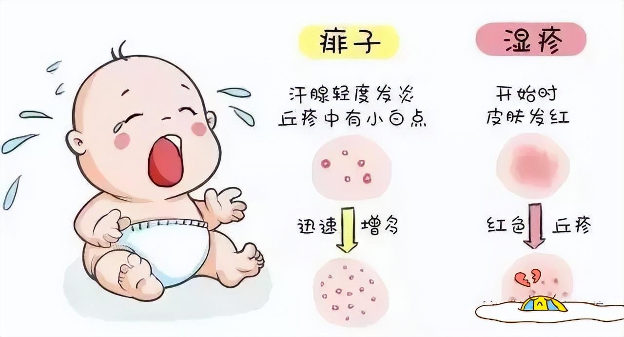 痱子和濕疹的區(qū)別，深入了解兩種常見皮膚狀況，痱子和濕疹的區(qū)別，常見皮膚狀況詳解