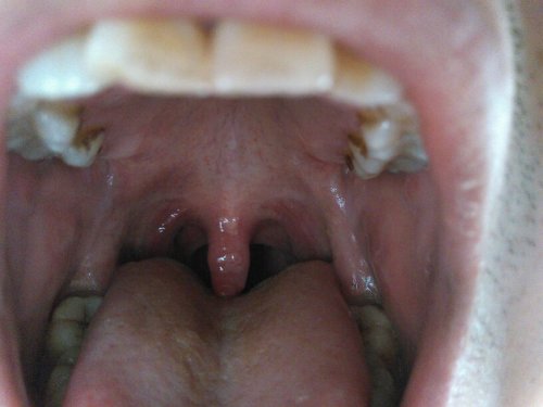 嗓子感覺(jué)糊了一層粘液，原因、緩解與預(yù)防策略，嗓子糊粘液，成因、緩解及預(yù)防策略