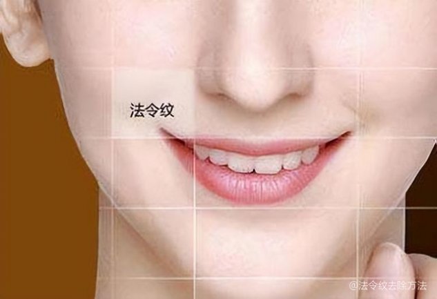 如何去除法令紋——打造青春無痕肌膚，如何消除法令紋，重塑青春無瑕肌膚